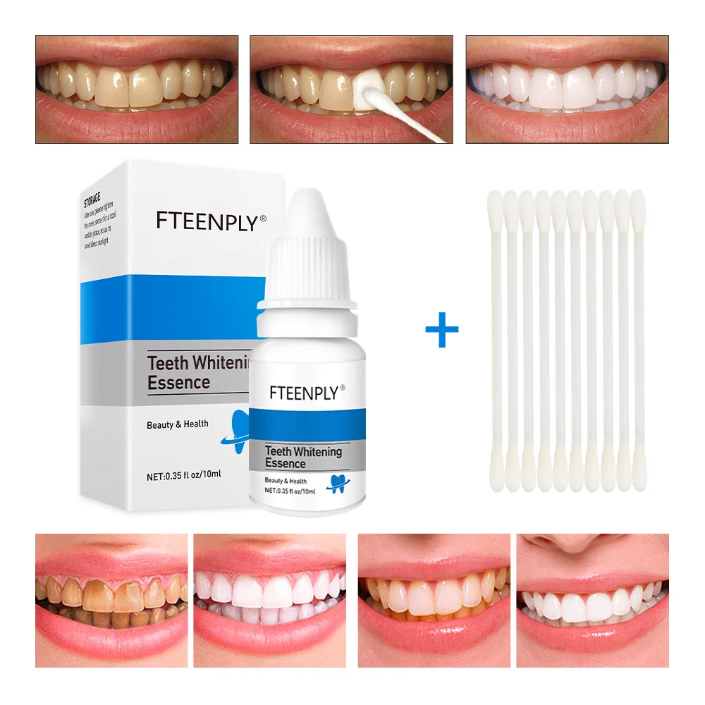 FTEENPLY Teeth Whitening Essen - огляд і ціна Teeth Whitening From Home