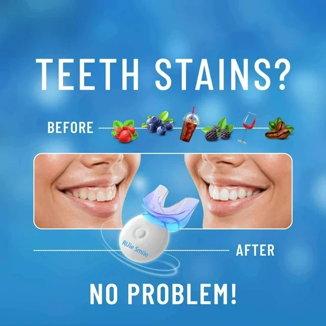 High Quality Cleaning Kit Wire - огляд і ціна Teeth Whitening At Home Kit