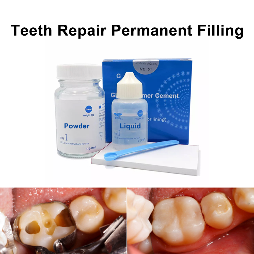 Permanent Teeth Filling Repair - огляд і ціна Teeth Whitening At Home Kit