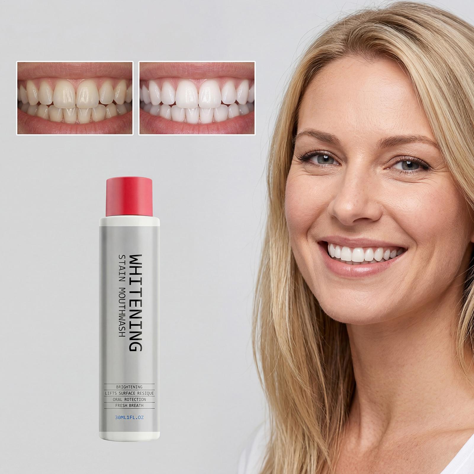 30ml Stain Whitening Mouthwash - огляд і ціна Teeth Whitening And Stain Removal