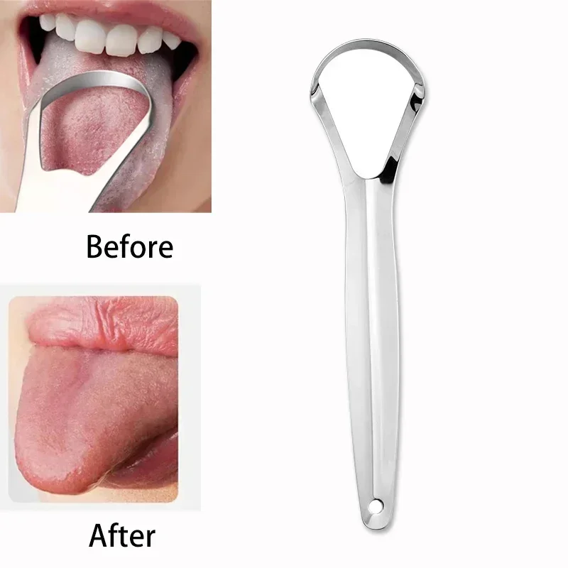 Halitosis Tongue Coating Tongu - огляд і ціна Tongue Scraper Metal