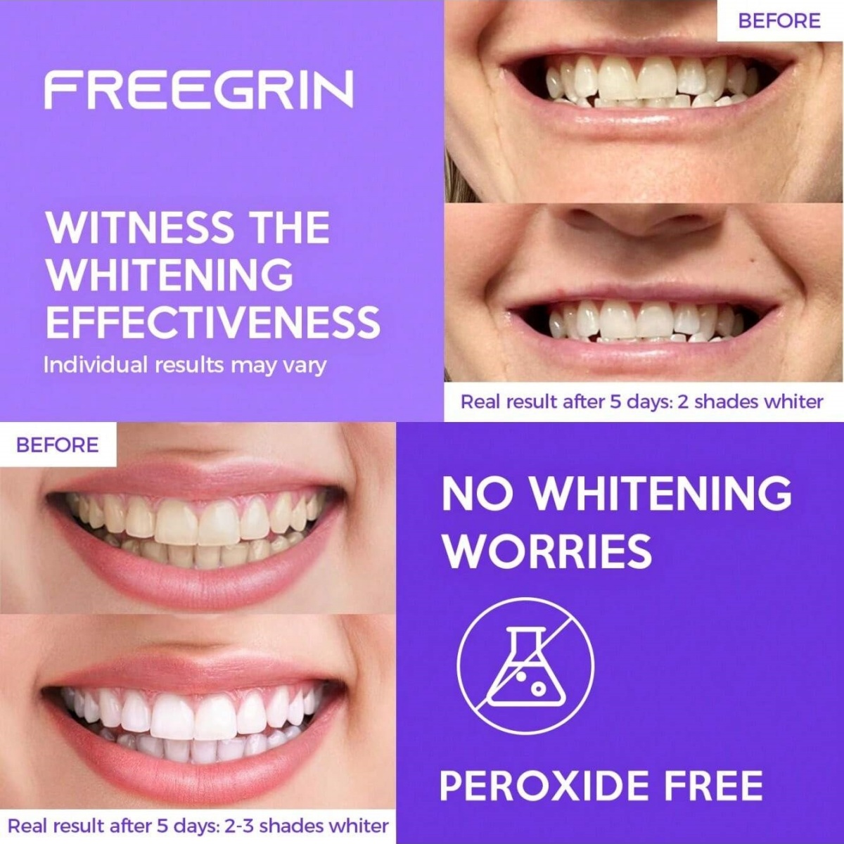 Deluxe Whitening Teeth Sticker - огляд і ціна Teeth Whitening From Home